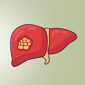 Biobran és a májrák