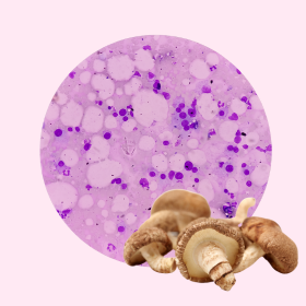 Myeloma Multiplex és a BioBran